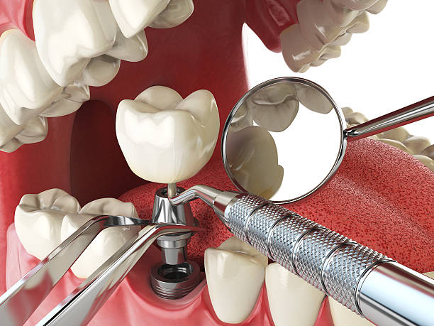Best Emergency Care for Gum Disease in Eminence, KY